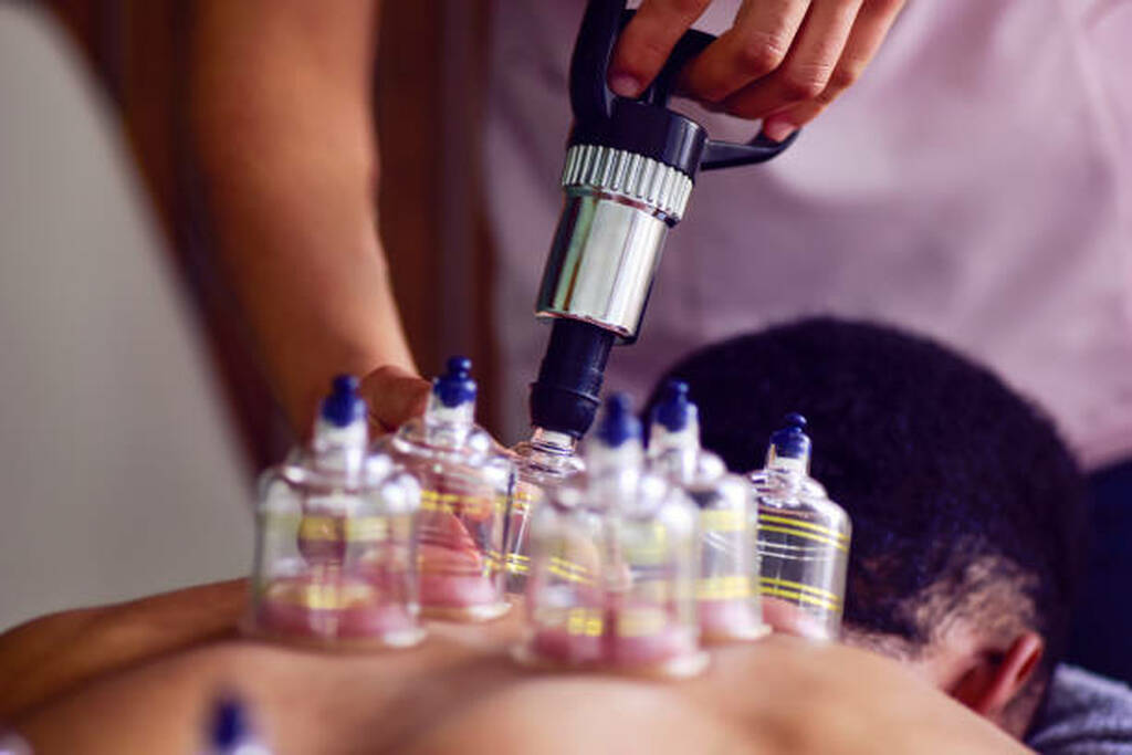 Hijama For General Pain Relief | Hijama Cure