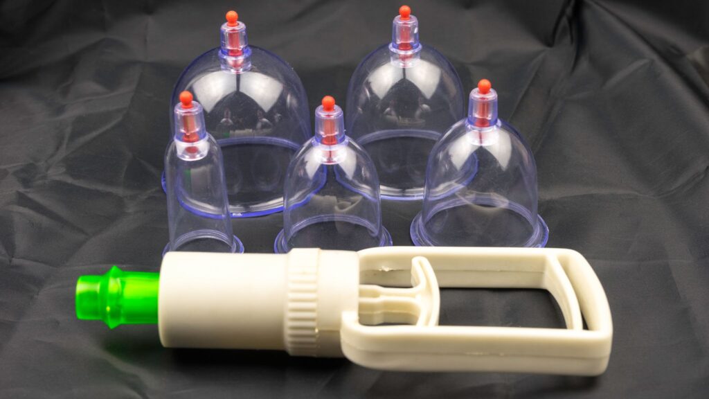 Cupping Therapy helps Combat Fatigue and Boost Vitality