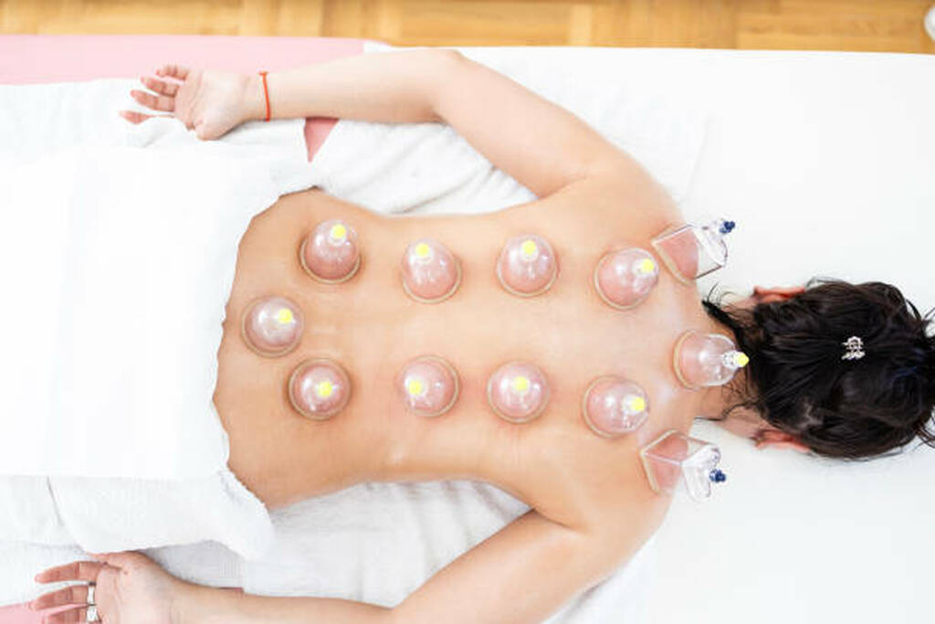 Why Thursday Is the Best Day for Hijama (And Days to Avoid)