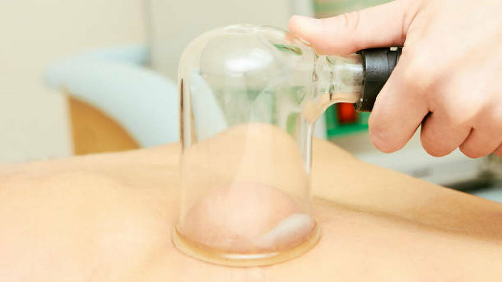 How Hijama May Help People With Fatty Liver & High Cholesterol