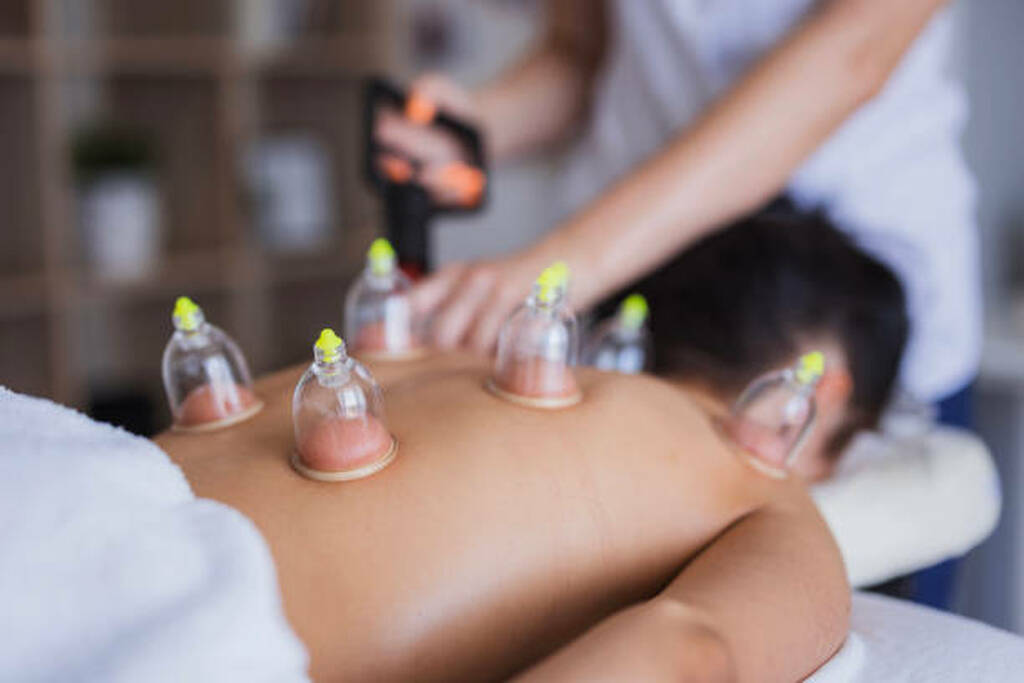 Hijama and Type 2 Diabetes | Boost Fasting Blood Glucose Levels