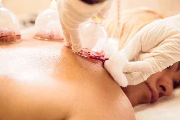 How Hijama Wet Cupping Can Boost Male Wellness & Fertility