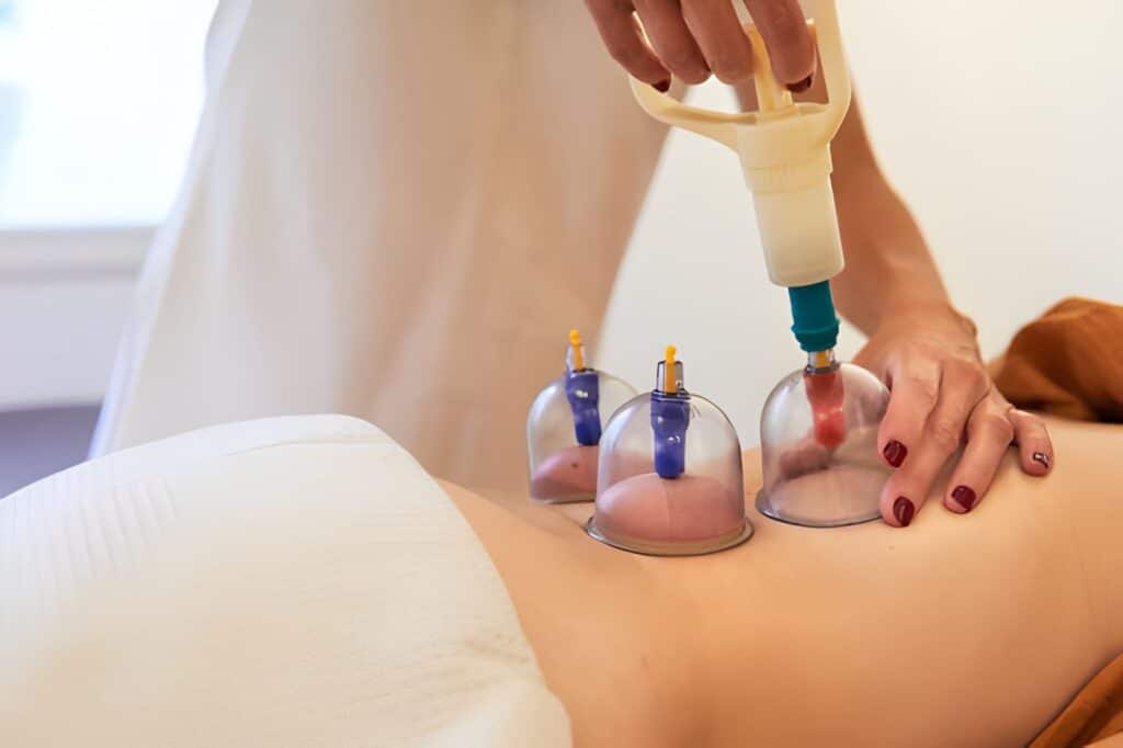Can Hijama Support Overall Eye Wellness?