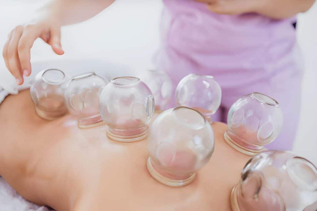 Does Hijama Help You Recover After a Bodybuilding Show?